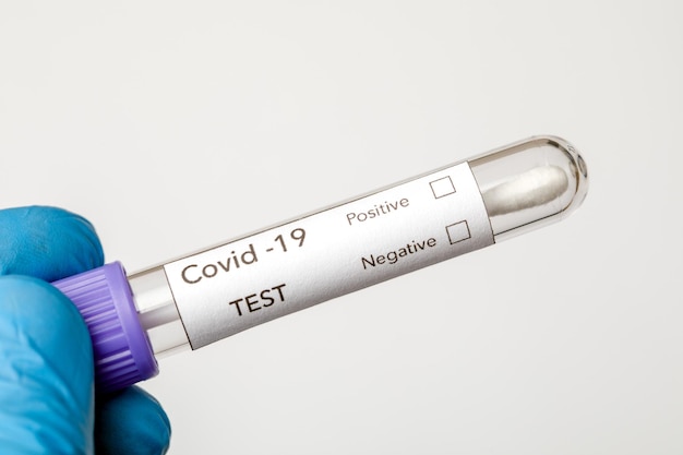 Blood test with the label covid delta variant