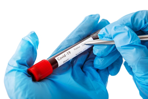 Blood test with the label covid delta variant