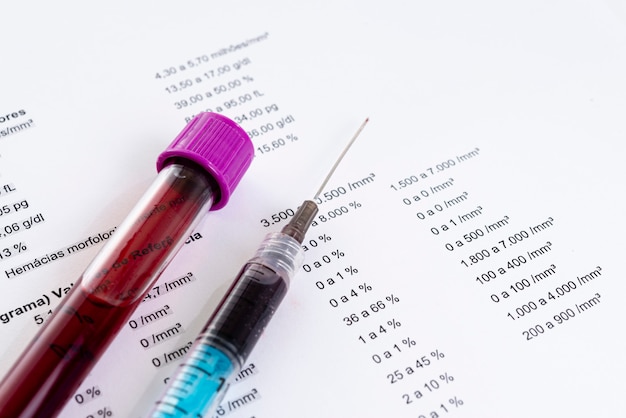 Blood tube for blood test with syringe. Full blood count.