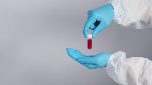 Provetta di sangue. test covid 19. mano del medico che tiene una provetta di sangue per analisi in laboratorio. tecnico in guanti medici che tengono test in provetta di sangue per la ricerca