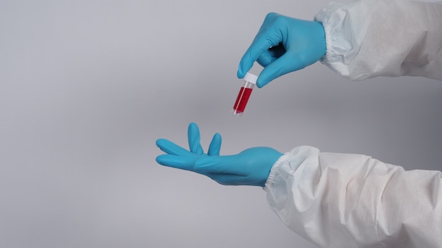 Provetta di sangue. test covid 19. mano del medico che tiene una provetta di sangue per analisi in laboratorio. tecnico in guanti medici che tengono test in provetta di sangue per la ricerca