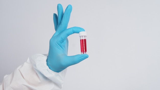 Blood tube. Covid 19 Test. doctor hand holding a blood sample tube for analysis in the lab . Technician in medical gloves holding blood tube test for research 