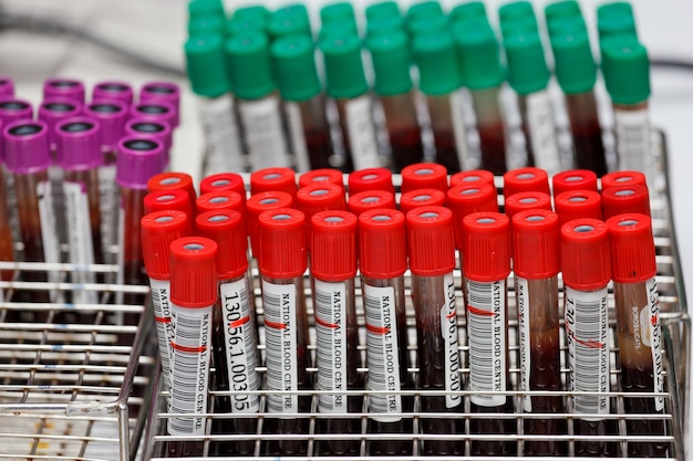 Blood tube for testing in labratory