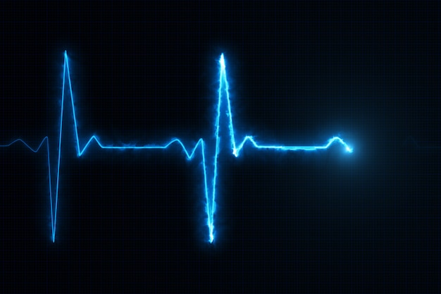 Photo blue cardiogram line