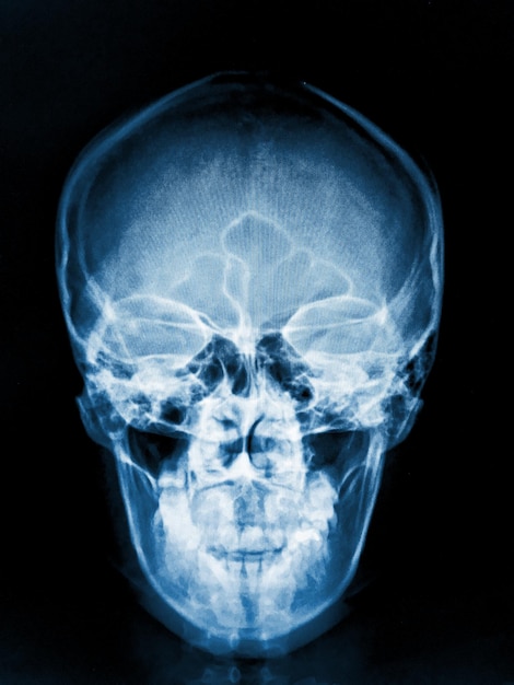 Foto un'immagine blu di un teschio umano con sopra la parola bone