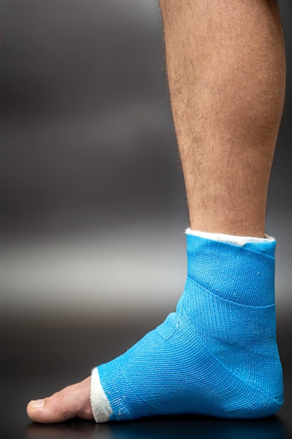 Blue splint ankle. bandaged leg cast on male patient on dark\
blurred background. sports injury concept.