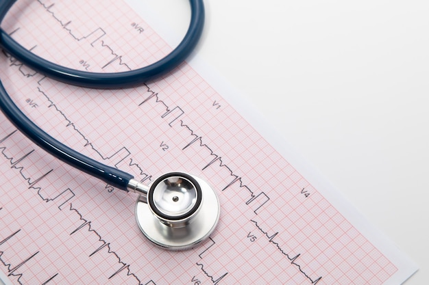 심전도 (ECG) 차트 용지에 파란색 청진기. ECG 심장 차트 스캔은 흰색에 격리됩니다. 의료 보험 및 의료 배경