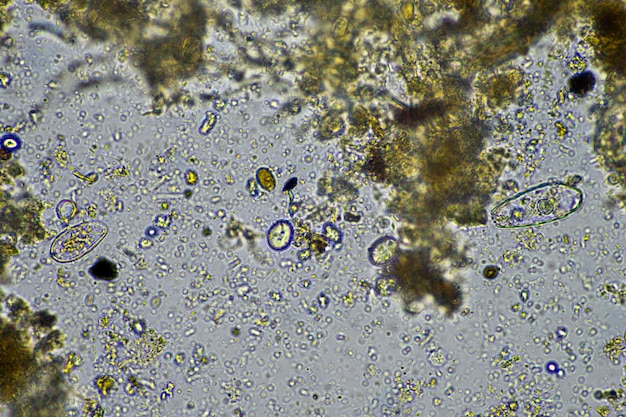 Foto bodemmicroben onder de microscoop micro-organismen met schimmels in compost