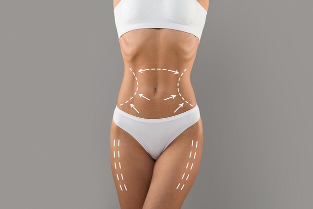 Photo body contouring slim female torso with drawn lifting up lines on it
