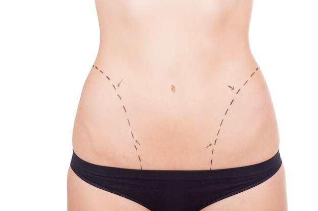 Body improvement. Cropped image of female torso with sketches on it isolated on white background