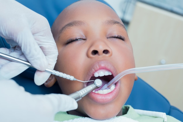 歯を持っている少年が歯医者によって検査されている