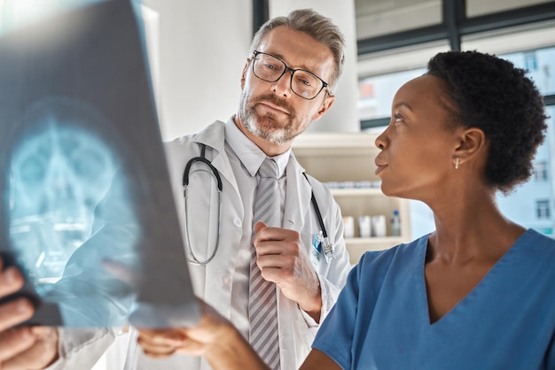 Brain x ray and neurology doctors in a meeting working on a skull injury in emergency room in a hospital Diversity cancer and healthcare medical neurologist checking mri or xray scan with teamwork