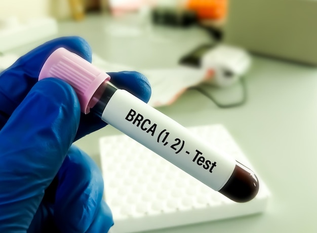 BRCA1 en BRCA2 zijn twee genen die belangrijk zijn voor de bestrijding van kanker, de zogenaamde tumorsuppressorgenen.