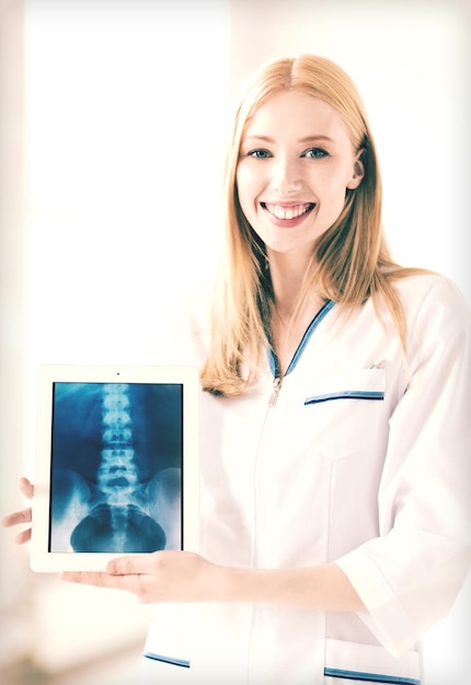 태블릿 PC에 엑스레이가 있는 여성 의사의 밝은 사진