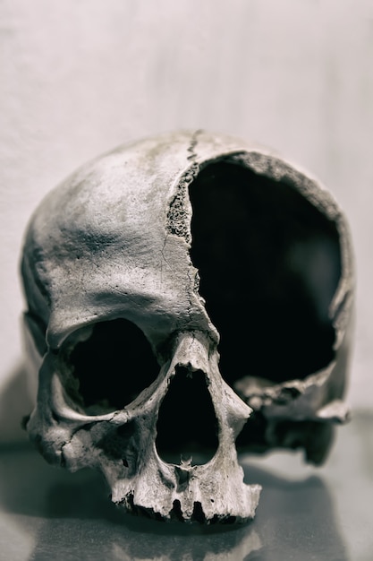 Сломанный человеческий череп крупным планом