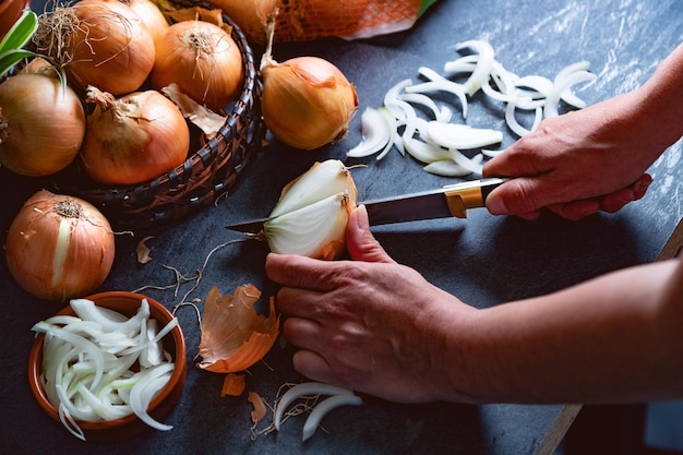 Brown onions and slices on wooden cutting board.Healthy food background.