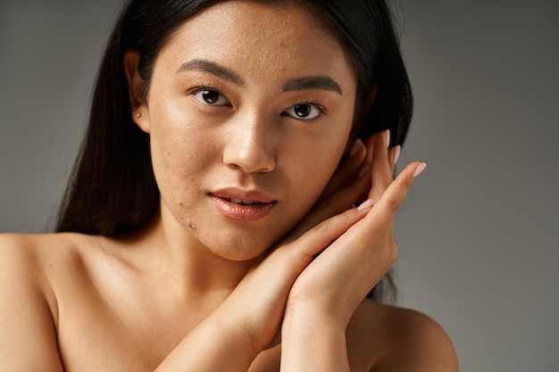 Photo brunette young asian girl with skin issues and bare shoulders looking at camera on grey background