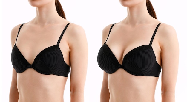 Premium Photo  Bust of a woman before and after breast augmentation surgery  woman in bra with different sizes of breast on white background plastic  surgery concept