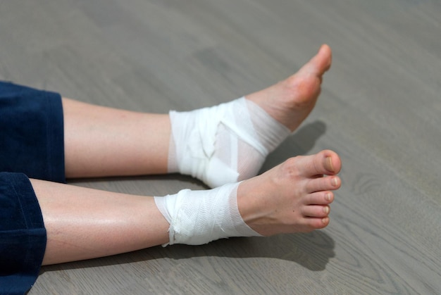 Callus on leg Girl uses ointment BandAid and bandage to treat calluse