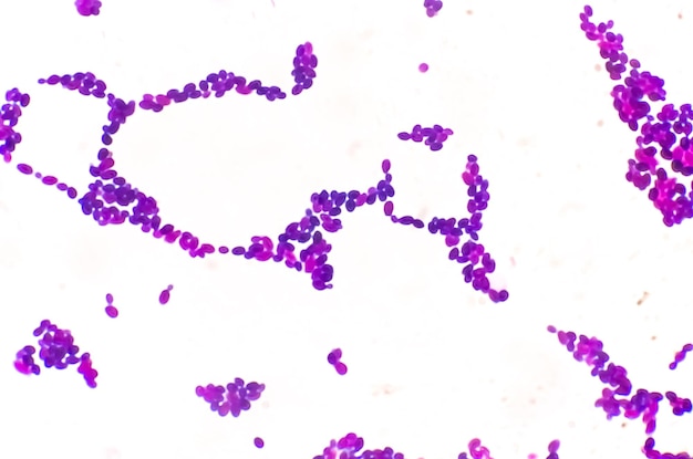 Candida-kolonie onder microscopisch zicht of candida albicans-schimmelinfectie