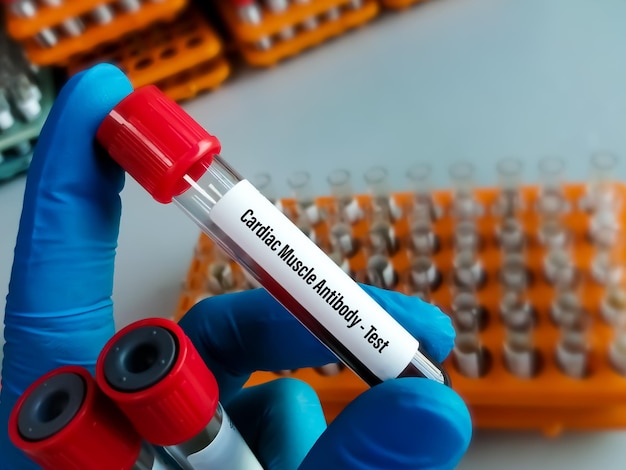 Cardiac Muscle Antibody test.