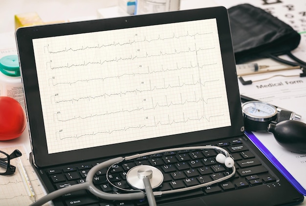 Foto cardio op het computerscherm van een dokter