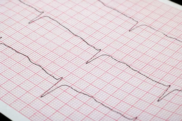 Cardiogram line close up heart diseases