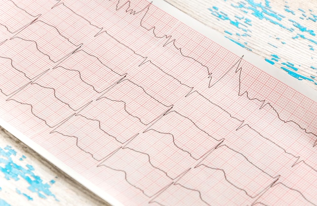 Cardiogram on an old wooden table.