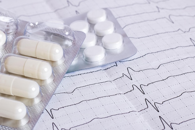 Cardiogram results on paper and pills heart health