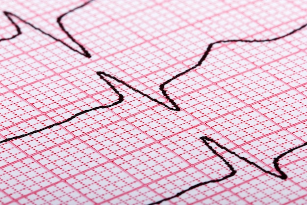 Cardiogram van hartslag op rood papier