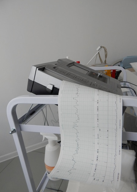 心臓活動の心電計の固定とグラフの印刷