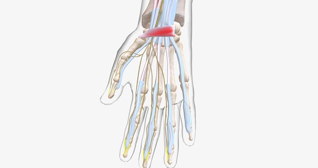 Carpal Tunnel Syndrome Wrist Pain isolated on white transparent bones