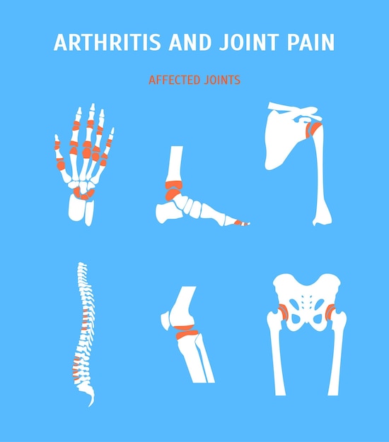 Photo cartoon arthritis and joint pain set human body for card poster or brochure healthcare concept flat design style vector illustration of illness