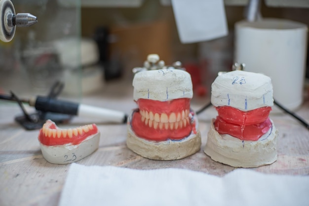 Photo casts of human teeth for implants ceramic jaw workshop for dental technician