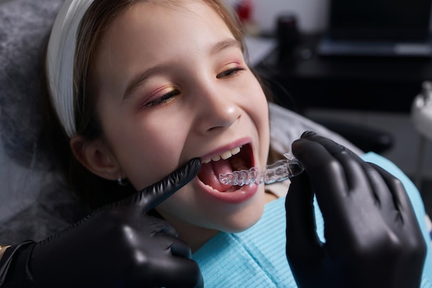 Caucasian little kid girl invisible aligner and pointing to her perfect straight teeth. Dental healthcare and confidence concept.