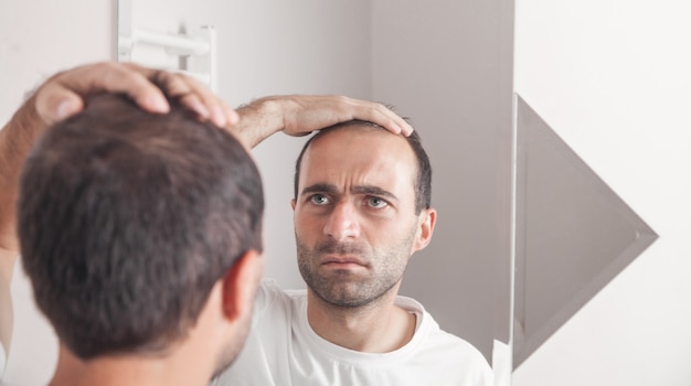 Caucasian man looking hair near mirror. Hair loss