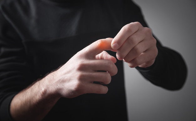 Caucasian man with finger pain.