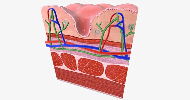 celiac disease is a chronic condition characterized an inflammatory allergic response of the digestive tract to gluten