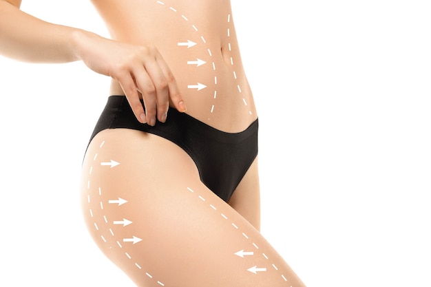 Cellulite removal plan. The black markings on young woman body preparing for plastic surgery. Concept of body correction, beauty, surgery procedure, liposuction. Fit female body. Copyspace.