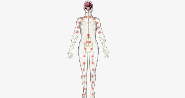 사진 중추 통증이라고도 불리는 중추 감작은 만성 통증의 발생과 관련된 상태입니다.