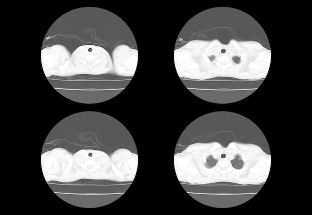 Chest ct scan and MRI creative images