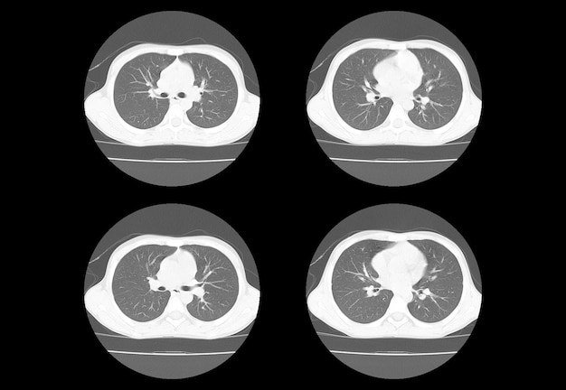 Chest ct scan and MRI creative images