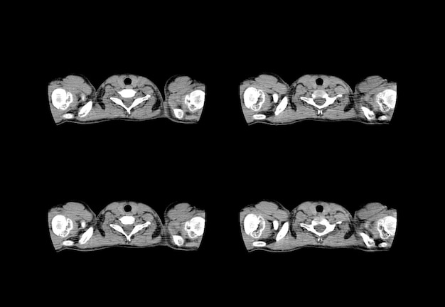 흉부 ct 스캔 및 MRI 크리에이티브 이미지