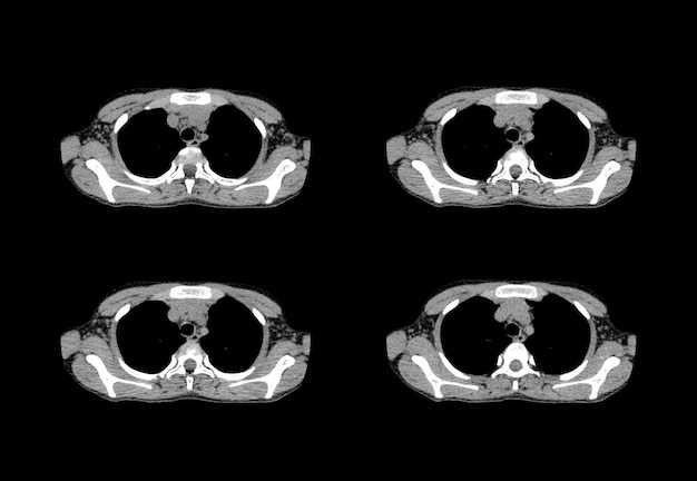 Chest ct scan and MRI creative images