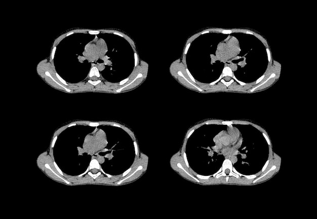 흉부 ct 스캔 및 MRI 크리에이티브 이미지
