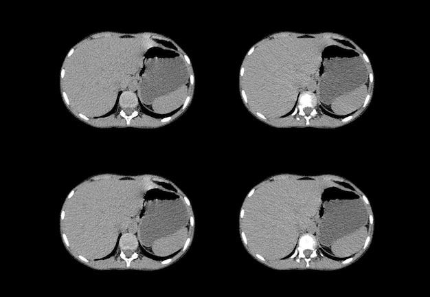 Chest ct scan and MRI creative images