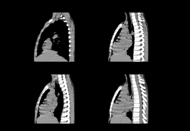 Chest ct scan and MRI creative images