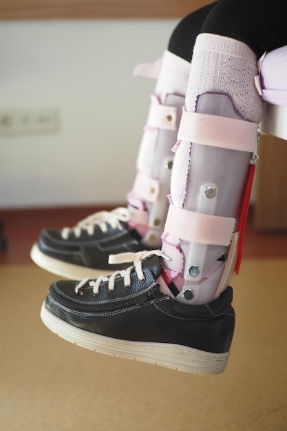 Child cerebral palsy disability legs orthosis