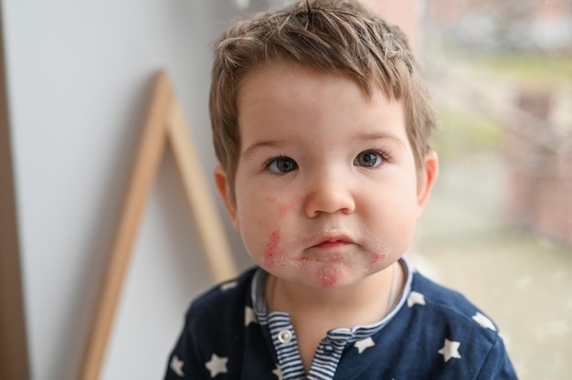 子供は顔を食べて発疹を持っています