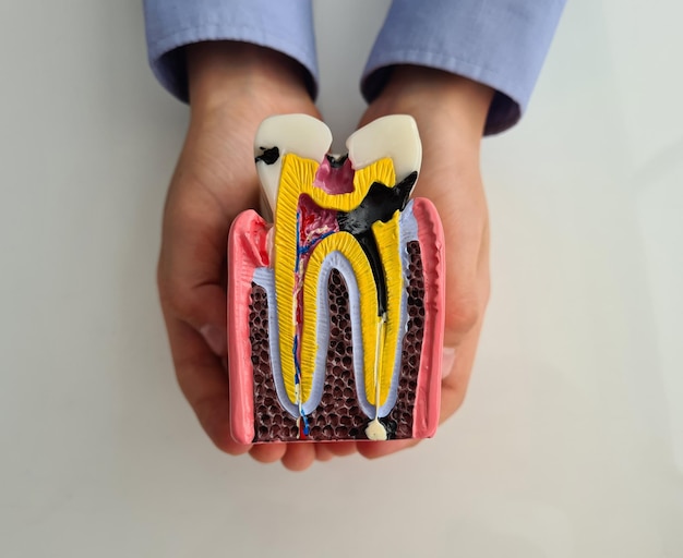 Child holds model of tooth with caries closeup